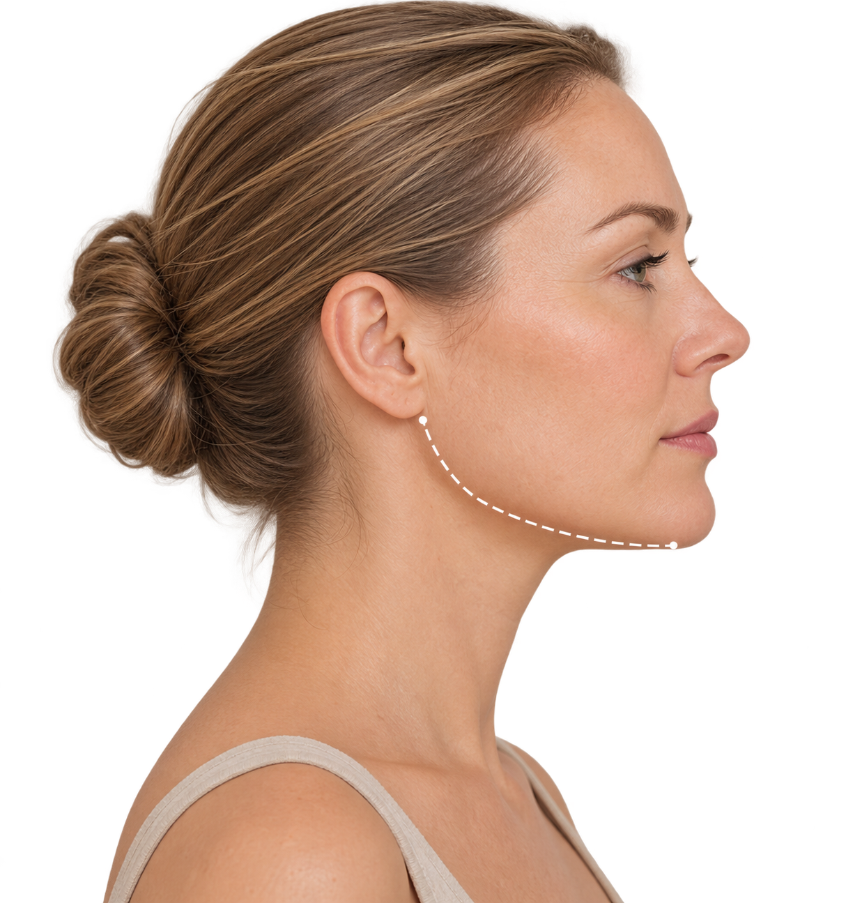 Side profile with a dashed line tracing the contour under the chin and along the jaw.